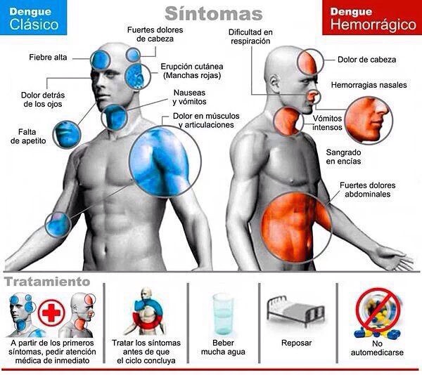 Síntomas del Dengue