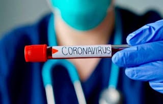 Santiago lidera casos de COVID-19 que se han registrado en últimas 24 horas 5
