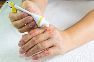 Sociedad Dominicana de Dermatología pide a la población no alarmarse ante infección cutánea en Haití 5