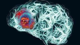 Alzheimer: cuáles son las tres señales de alerta metabólica a los 35 años 5