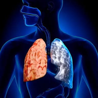 La salud que preocupa al mundo: cuáles son las 5 enfermedades más graves y cómo prevenirlas 10 La salud que preocupa al mundo: cuáles son las 5 enfermedades más graves y cómo prevenirlas