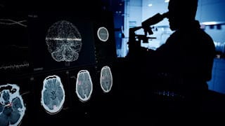 Alzheimer: cuáles son las tres señales de alerta metabólica a los 35 años