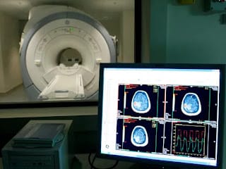 Alzheimer: cuáles son las tres señales de alerta metabólica a los 35 años