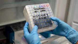 4 claves para entender por qué la viruela del mono ya es una emergencia internacional 9 4 claves para entender por qué la viruela del mono ya es una emergencia internacional
