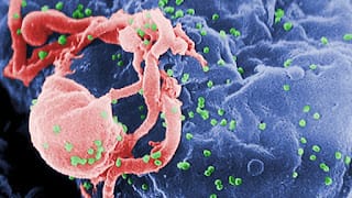 Novedosa terapia podría 'cortar' el VIH de las células infectadas 9 Novedosa terapia podría 'cortar' el VIH de las células infectadas