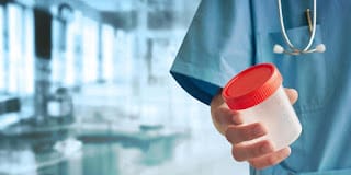 Un avance en la detección del cáncer de próstata: la prueba de orina podría evitar biopsias innecesarias 5