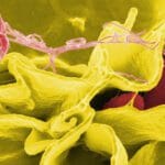 Científicos chinos desarrollan bacteria modificada que podría transformar el tratamiento del cáncer 8 Científicos chinos desarrollan bacteria modificada que podría transformar el tratamiento del cáncer