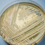 Hongo resistente a medicamentos se disemina en EE.UU. con casos en aumento constante 7 Estudio revela aumento alarmante de infecciones por el hongo Candida auris, resistente a tratamientos y con alta mortalidad.