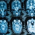 Avance médico: Implante cerebral convierte señales neuronales en habla sintetizada 7 Una mujer recuperó su capacidad de hablar mediante un implante cerebral que decodifica su actividad neuronal y la convierte en voz artificial.
