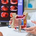 La pérdida de la proteína p53 podría impulsar el cáncer de colon en etapas tempranas 3 Un estudio del CNIO revela que la pérdida de la proteína p53 en etapas iniciales favorece el desarrollo de tumores colorrectales.