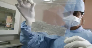 Dominicana avanza con banco de piel y expansión de servicios de salud